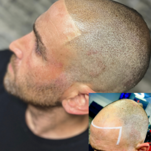 Full SMP Procedure