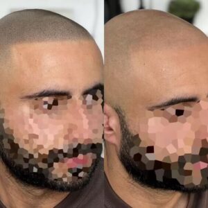 Touch Up